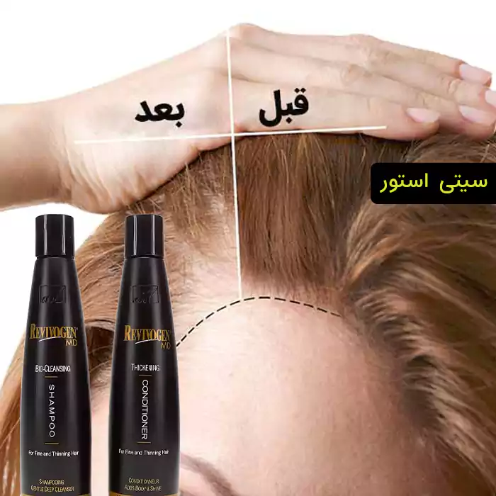 محلول نرمکننده و ضخیمکننده مو ریوایوژن