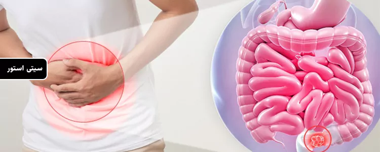 مکمل Digest Complete از برند Enzymedica